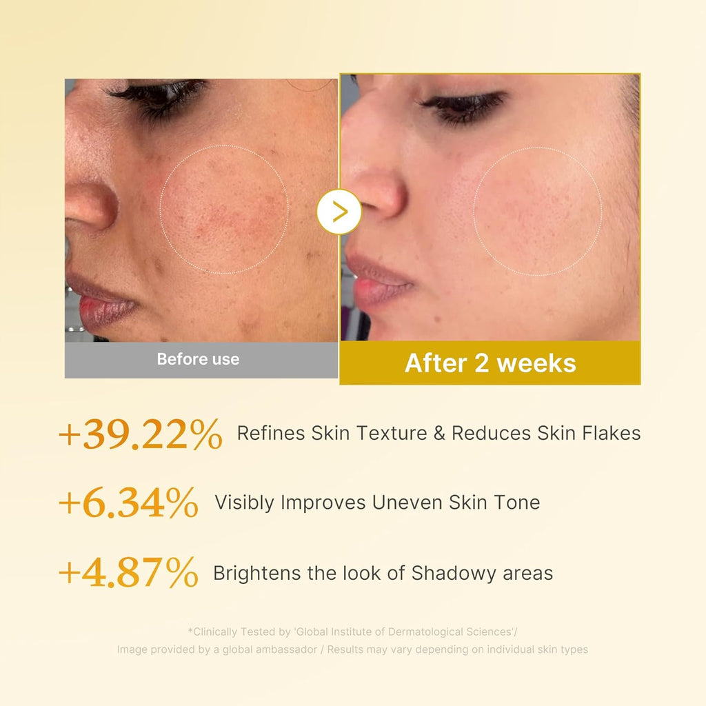 Kojic Acid and Turmeric Smoothing Toner for Face and Body, 8.45 Fl. Oz.
