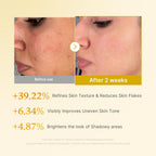 Kojic Acid and Turmeric Smoothing Toner for Face and Body, 8.45 Fl. Oz.