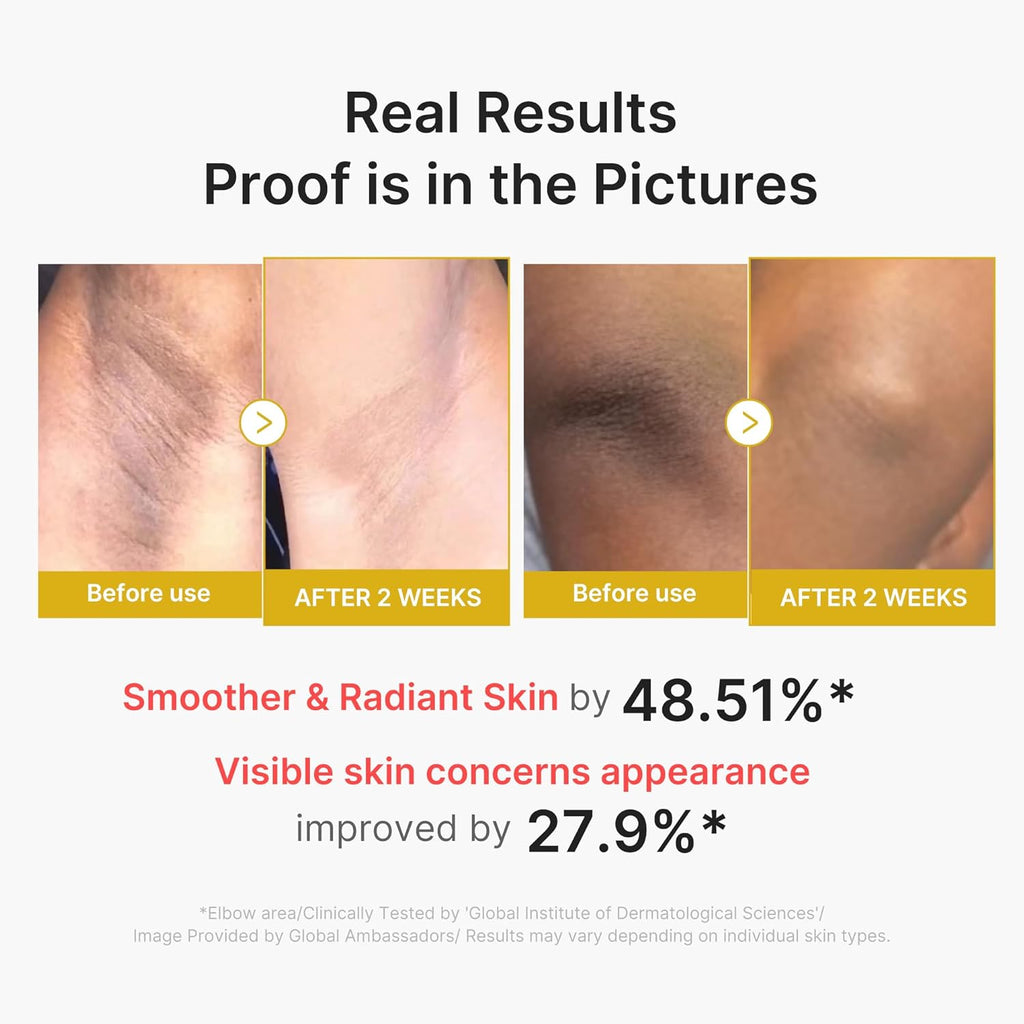 Body Peel Shot with Kojic Acid Turmeric, Brightening & Exfoliating