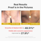 Body Peel Shot with Kojic Acid Turmeric, Brightening & Exfoliating