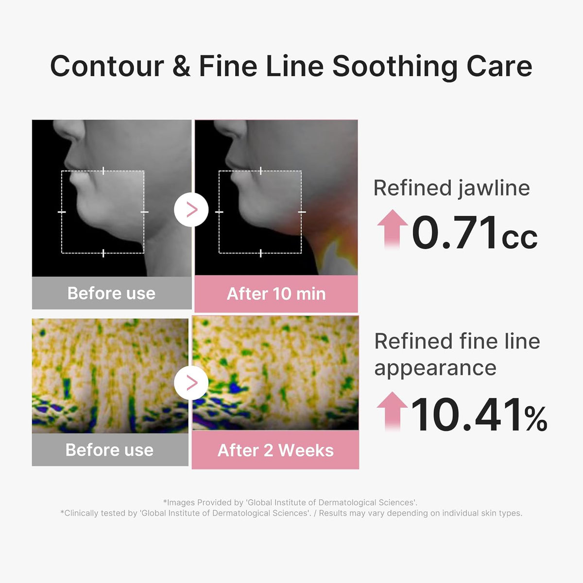 PDRN Pink Tension-Up 3-Step Contouring Sheet Mask