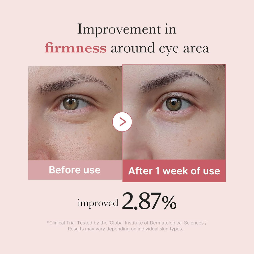 Advanced Eye Serum with Salmon DNA PDRN, Peptides, and Retinol for Reducing Fine Lines
