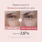 Advanced Eye Serum with Salmon DNA PDRN, Peptides, and Retinol for Reducing Fine Lines