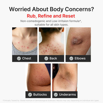 Body Peel Shot with Kojic Acid Turmeric, Brightening & Exfoliating